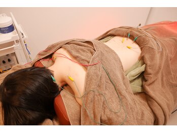 アキューレ(Acure)/【パルスを使った鍼灸施術】
