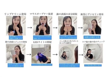 ホワイトニングショップ 三島店(WHITENING SHOP)/【ホワイトニングの流れ】まとめ