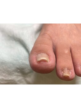 爪の悩みを解消できる（ケア含む）