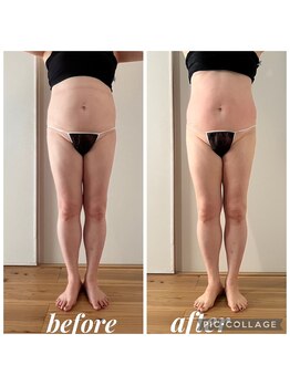 クリオネ(Clione)/ぽっこりお腹改善 腸活