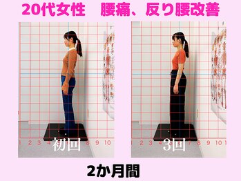 さく整骨院 新松戸店/20代会社員、反腰、腰痛改善♪