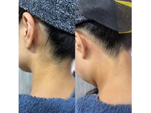 ビーデル(Wieder)