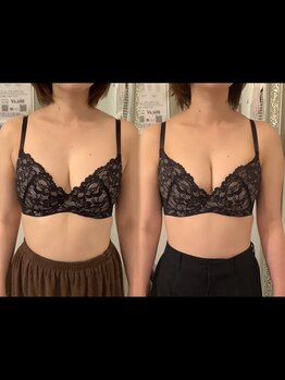 ヴィーナス(Venus)/バストの位置で小顔効果