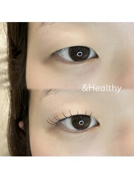 リッチオ(Riccio)/アンドヘルシー100本