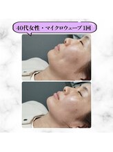 グランディールアン(GRANDIR UN)/フェイスラインスッキリ