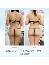 エスプレッソ(espresso,)/【半身12回】メリハリのある体へ