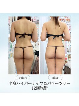 エスプレッソ(espresso,)/【半身12回】メリハリのある体へ