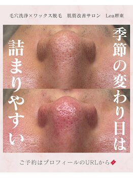 レア(Lea)/季節や変わり目は要注意