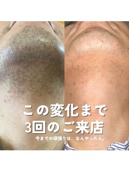 テディベース(TEDDY BASE)の写真/「清潔感はムダ毛の管理から。」仕事もプライベートも印象が変わる大人男性の身だしなみ。初めての方にも◎