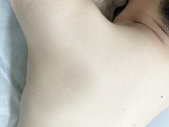 ナノハナ/鹿沼市の全身脱毛美容室ナノハナ