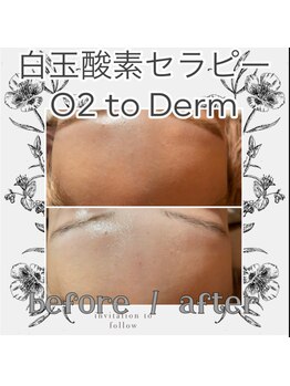 1527/韓国では定番管理