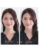 ラグラン銀座メディカルエステ 高輪ゲートウェイ店/ 小顔施術のお写真