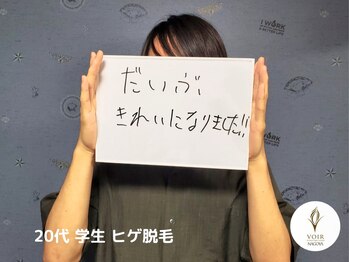 ヴォアール 名古屋店(VOIR)/ひげ脱毛　お客様の声