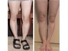 【学割U18ずっと割引き】早期発見で防げる。子供のO脚、内また歩行、不良姿勢