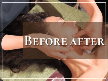 ヤワラ 長与店(yawara)/施術ビフォーアフターの紹介