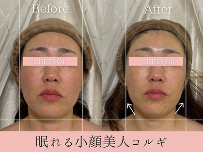セレソル(CERESOL)の写真