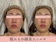 セレソル(CERESOL)の写真