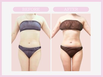 スリムライン 山形店(The Slim Line)/before→after