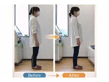 しんぐう整体院/猫背矯正　50代女性