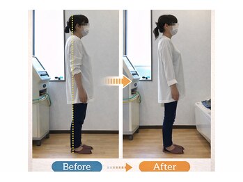 しんぐう整体院/猫背矯正 50代女性