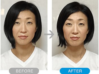ワト(WATO)/■小顔施術(before→after)
