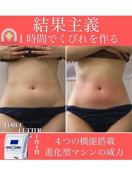 ハピココ(HAPIKOKO)/夏!クビレにはコレ!