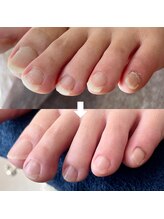 ビビィ(vivie)/男女関係なくお受けしています