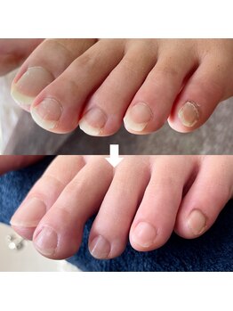 ビビィ(vivie)/男女関係なくお受けしています