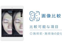 テセラ(Tethere)/画像比較