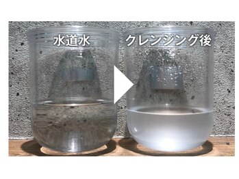 アンス(Ance)/毛穴汚れの様子。。1回の効果！