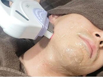 エステティック らぽーる(Rapport)の写真/【ヒゲこそタイパ◎爆抜けで結果出し★】ひげ剃りが面倒な方、カミソリ負けでお悩みの方におすすめ！