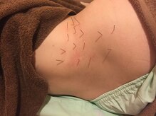 スプーノ 神楽坂(Spoonno)/急性期の腰痛も問題ないです。