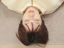 四条大宮アシスト鍼灸整骨院/美容鍼（電流あり）