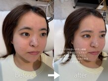 ジョリー(JOLi)/まつげパーマ＋眉毛ワックス