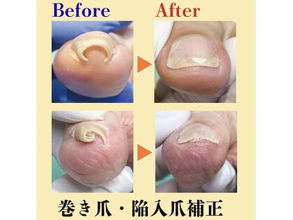 巻き爪補正店 北千住店の写真