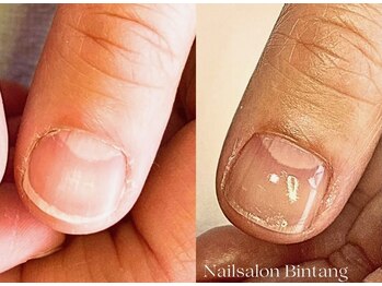 自爪派さん 自爪育成コース