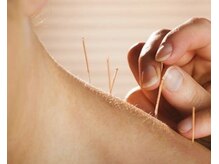 キュアサロン Kスタジオの雰囲気(鍼灸もあり。症状に合わせて施術をします)