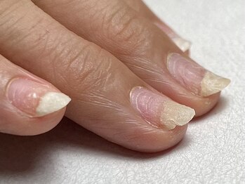 プライベートネイルサロン ケイト(Kate)の写真/本気のケアで深爪や噛むクセ、傷んだ爪から卒業★自爪育成特化サロンだから叶う、感動体験をあなたに♪
