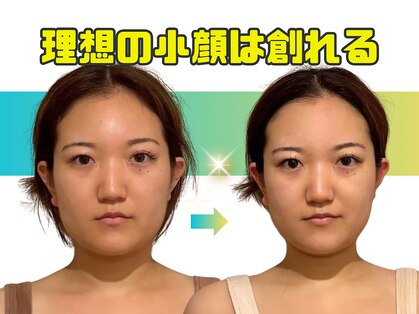 ミライ小顔 溝の口店(MIRAI小顔)の写真