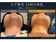 サボ 福岡(SAVO)の写真