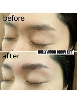 ラドアー(Radoor)/ハリウッドブロウリフト