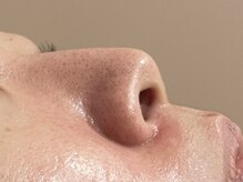 アンドユー ヨコハマ(&U Yokohama)/クリスティーナ施術前