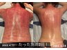 【なかなか痩せない二の腕・背中・脇腹】痩身上半身集中セル分解コース