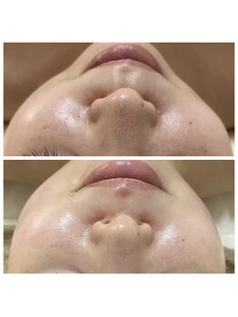 ルルボーテ(Loulou Beaute)/waxxxx