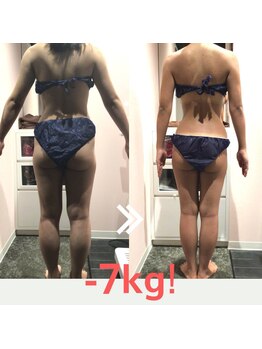 ビューティーリバース 横浜店/★モニター様★2ヵ月-7kgに成功