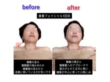 ブランシュール(blancheur)