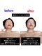 ブランシュール(blancheur)の写真/お顔のたるみが気になる方へ必見!小顔効果◎美骨フェイシャルをご体感下さい♪