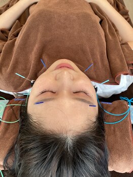 ハリファ鍼灸院 横浜関内院(HariFa鍼灸院)/美容施術