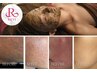 【毛穴開き撃退★角質ケア】何度でもOK♪ REVI陶器ハーブピーリング2ｇ