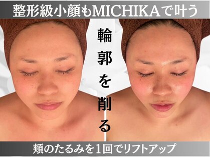 ミチカ(MICHIKA)の写真